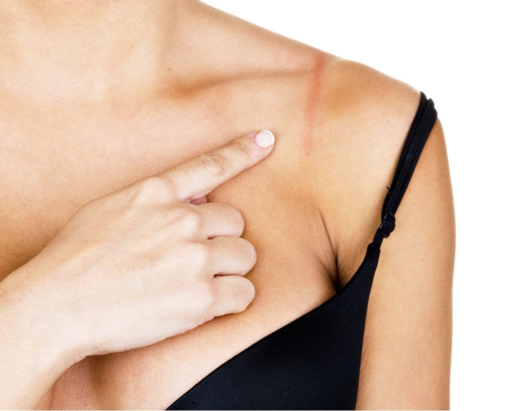 How To Fix Common Bra Problems